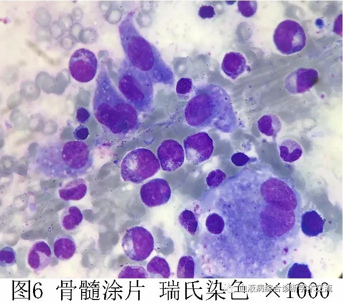 朗格汉斯细胞染色图片