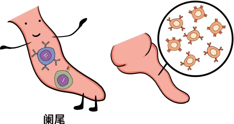不到万不得已,千万别割阑尾!