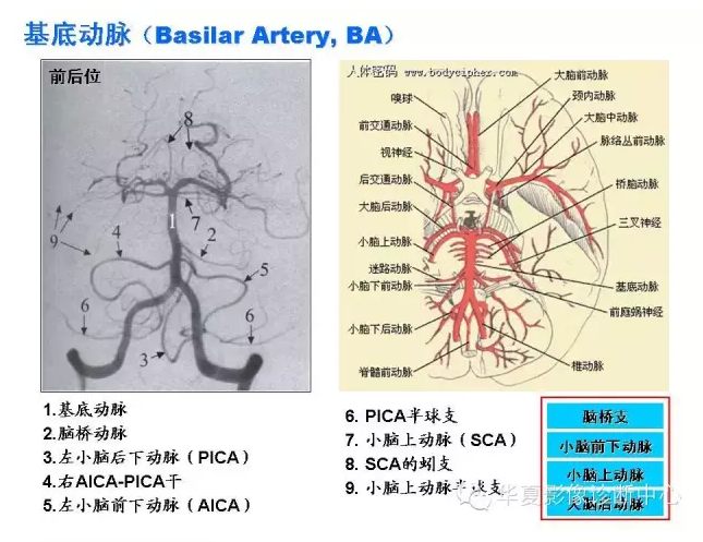 脑动脉血管分布图图片