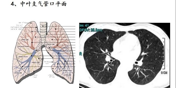 有了这个ct口诀,你还敢说记不住肺分段?