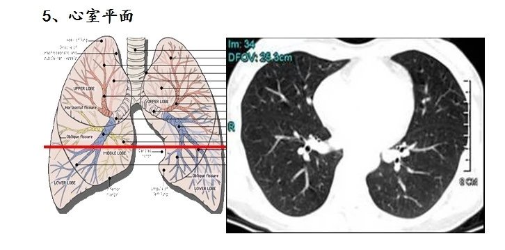 左肺下叶各段位置图图片