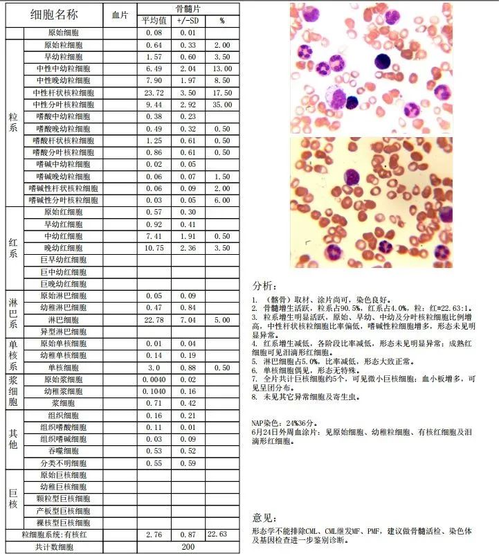 有核红细胞及泪滴形红细胞,建议做nap积分,骨髓细胞形态学,骨髓活检