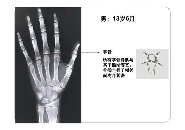 各年龄段的骨骼线图图片