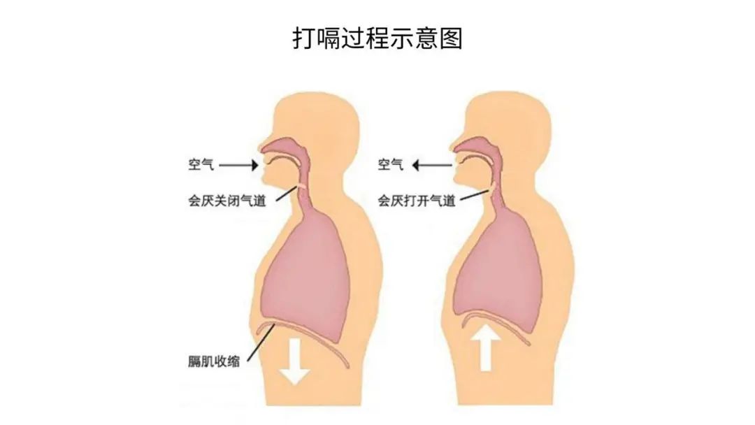 这种打嗝是疾病示警信号,需警惕_医学界-助力医生临床决策和职业成长